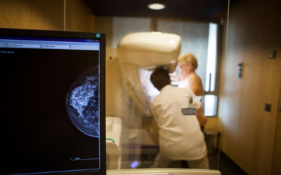 Digital Breast Tomosynthesis (DBT) Coding in 2015