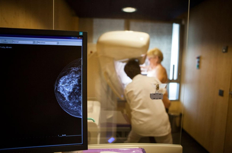 Digital Breast Tomosynthesis (DBT) Coding in 2015