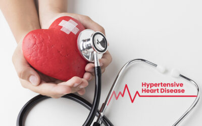 ICD-10-CM Coding for Hypertensive Heart Disease and Related Conditions