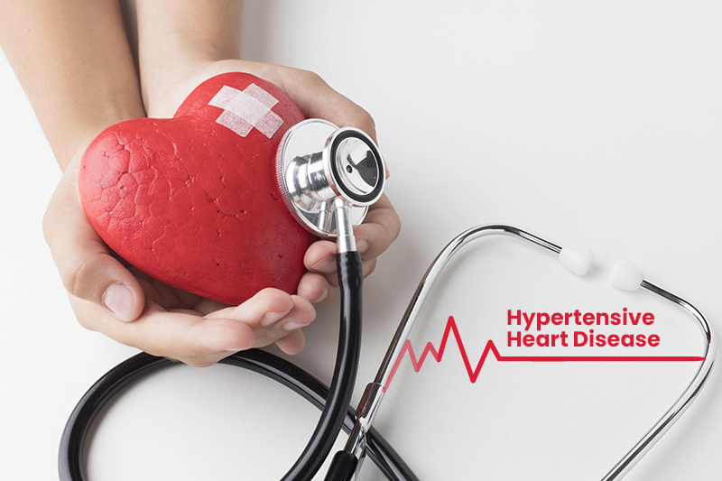 Coding for Hypertensive Heart Disease