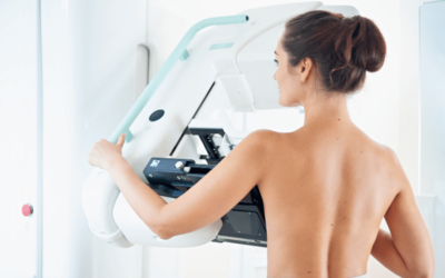 Use New CPT Codes Correctly to Maximize Reimbursement for Mammography in 2017