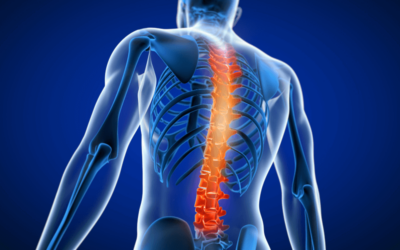 New CPT Codes and Coverage Criteria for Interlaminar Stabilization for Spinal Stenosis