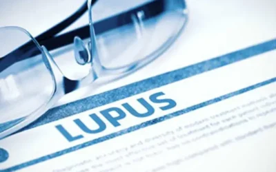 How To Report Systemic Lupus Erythematosus with the Correct ICD-10 Codes