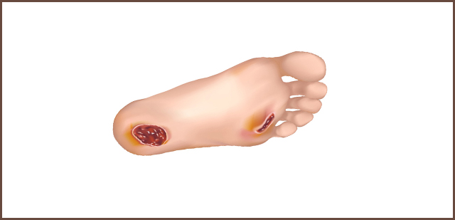 10 Common Foot Problems in Adults: Causes and Treatment