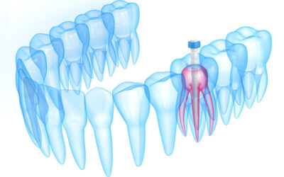 Why Does “D2950” Dental Core Buildup Code Face More Claim Denials?