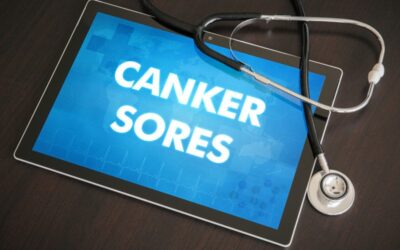 Billing and Coding Canker Sores, a Common Oral Condition