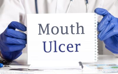 Documenting and Coding Oral Mucositis – A Painful Mouth Ulcer Condition