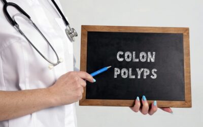 Colon Polyps – Diagnosis and ICD-10 Coding