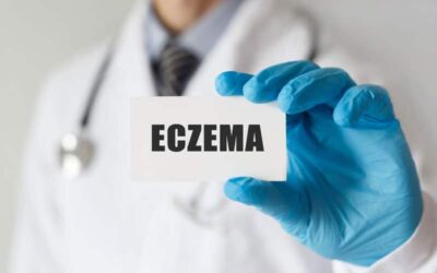 ICD-10 Codes To Report Eczema