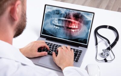 Medical Coding For Alveoloplasty With Extractions For A Dental Billing Company