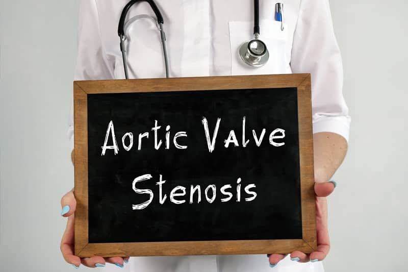 How To Code Aortic Valve Diseases