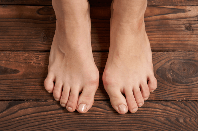 Codes to Report Foot Deformities in Podiatry Billing