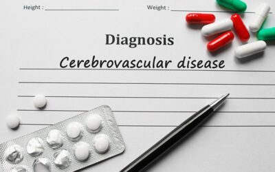 Top 5 Cerebrovascular Diseases and Their Related ICD-10 Codes