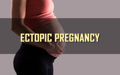 How to Code and Bill for Ectopic Pregnancy and its Treatment