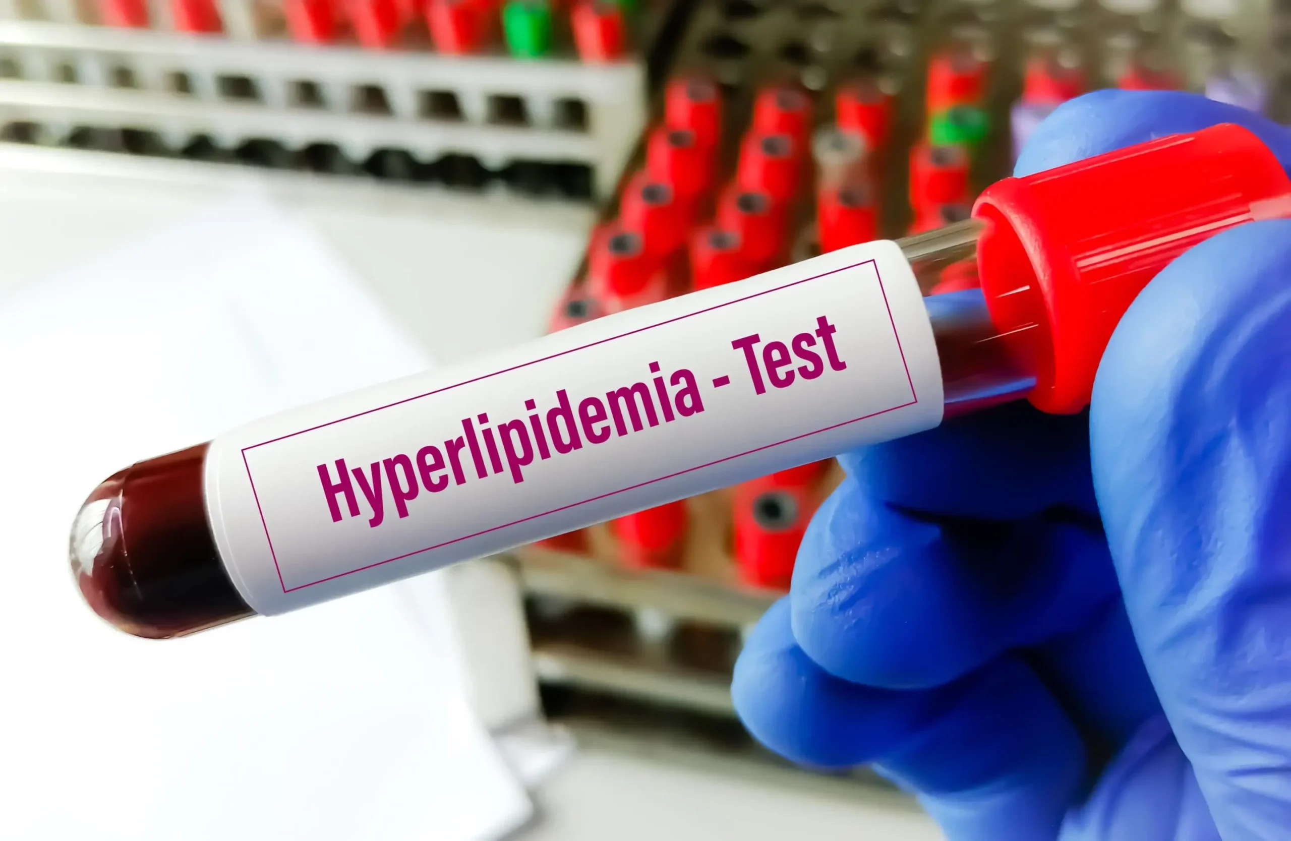 Hyperlipidemia