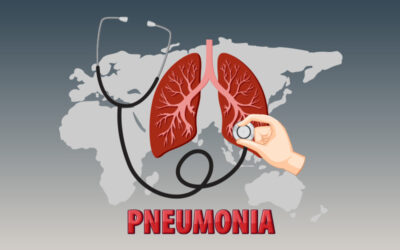 Medical Coding and Documentation Guidelines for Pneumonia