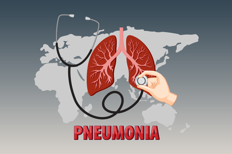 Documenting and Coding Pneumonia