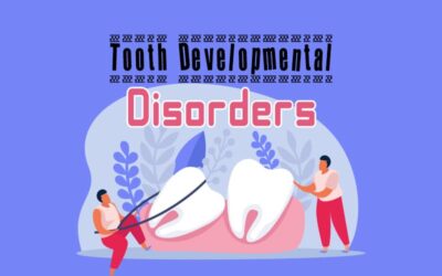 What Are the ICD-10 Codes to Report Tooth Developmental Disorders?