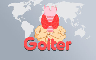 Goiter – Symptoms, Causes and Diagnosis Codes