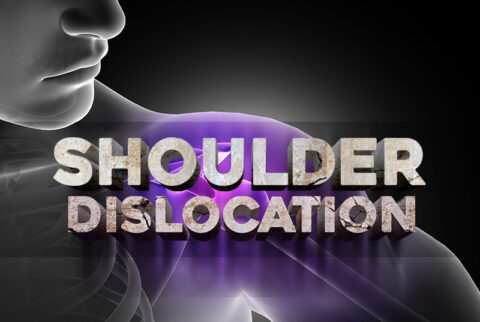 ICD-10 Codes to Report Shoulder Dislocation