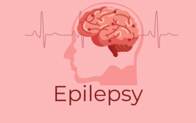 How to Bill and Code for Epilepsy Surgery