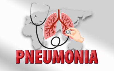 Understanding Pneumonia ICD-10 Codes for Accurate Billing