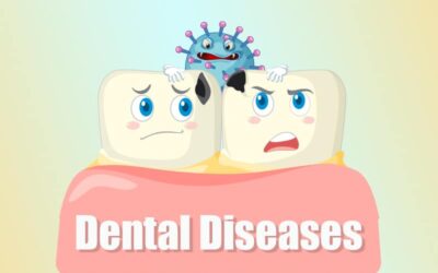 ICD-10 Codes to Report Spring Dental Diseases