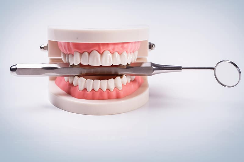 Dental Core Buildup Reimbursement Challenges