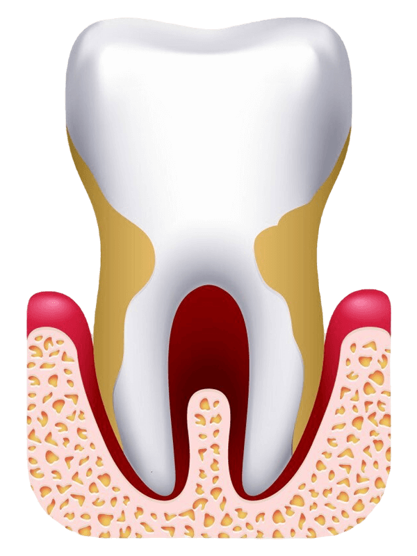 Periodontics Billing Why Choose OSI