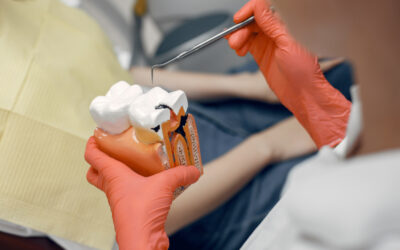 Navigating Root Canal Billing: Maximize Reimbursements Minimize Hassles